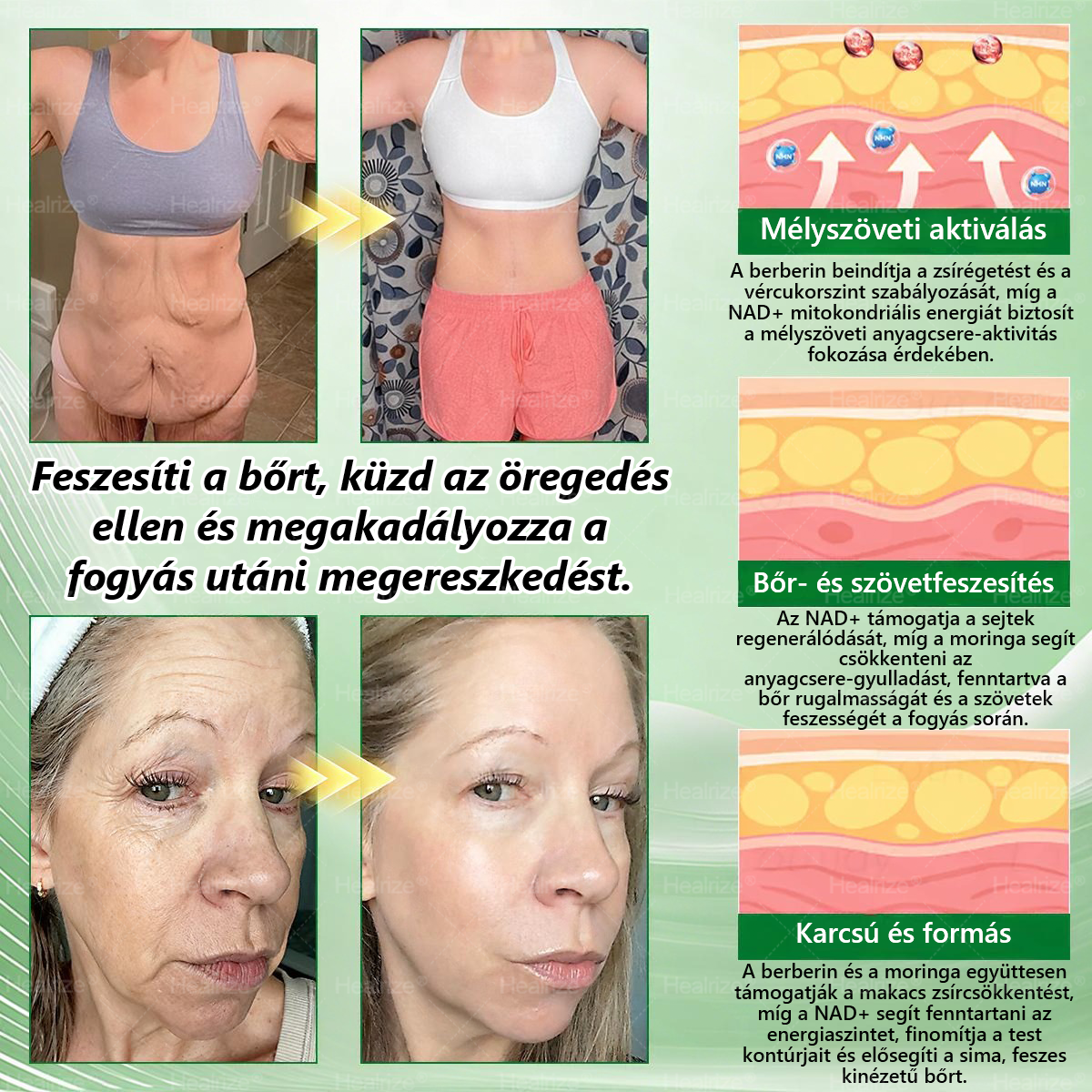 Hivatalos Webáruház | 🧑‍⚕️🩺 𝑯𝒆𝒂𝒍𝒓𝒊𝒛𝒆® Moringa · Berberin × NAD+ 10-ben-1 Fejlett Nanomikrotűs Tapasz — Naponta Egyszer, Látható Eredmény 7 Nap Alatt